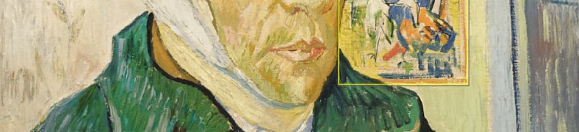 Mystery of Vincent Van Gogh’s Ear: Myths vs Facts